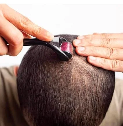 derma roller 1 mm men mattress hair beard growth 4 derma roller 1 mm men mattress hair beard growth 4